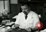 Image of Gall bladder pathology New York United States USA, 1948, second 39 stock footage video 65675020836