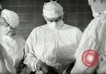 Image of operating room surgery New York United States USA, 1948, second 25 stock footage video 65675020858