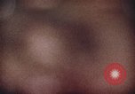 Immagine di Kessler Istituto per la riabilitazione United States USA, 1974, secondo 1 filmato di repertorio 65675021549