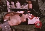 Image of wounded United States soldier Vietnam, 1969, second 60 stock footage video 65675022609