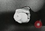 Image of antiseptic surgery United States USA, 1937, second 34 stock footage video 65675023089