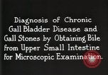 Image Division Gastro-Intestinal Detroit Michigan Henry Ford Hospital USA, 1936, de la seconde 24 séquences d'archives historiques vidéo 65675023148