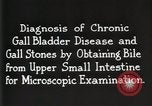 Image Division Gastro-Intestinal Detroit Michigan Henry Ford Hospital USA, 1936, de la seconde 25 séquences d'archives historiques vidéo 65675023148