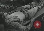 Image of Bougainville wounded US soldier Bougainville Island Papua New Guinea, 1944, second 20 stock footage video 65675023690