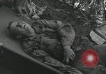 Image of Bougainville wounded US soldier Bougainville Island Papua New Guinea, 1944, second 26 stock footage video 65675023690