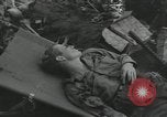 Image of Bougainville wounded US soldier Bougainville Island Papua New Guinea, 1944, second 30 stock footage video 65675023690
