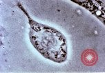 Image of Cancer research Boston Massachusetts USA, 1957, second 41 stock footage video 65675023828