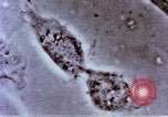 Image of Cancer research Boston Massachusetts USA, 1957, second 46 stock footage video 65675023828