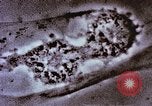 Image of Cancer research Boston Massachusetts USA, 1957, second 57 stock footage video 65675023828