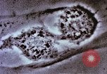 Image of Cancer research Boston Massachusetts USA, 1957, second 58 stock footage video 65675023828
