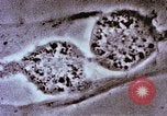 Image of Cancer research Boston Massachusetts USA, 1957, second 59 stock footage video 65675023828