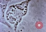 Image of Cancer research Boston Massachusetts USA, 1957, second 60 stock footage video 65675023828