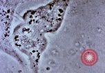 Image of Cancer research Boston Massachusetts USA, 1957, second 62 stock footage video 65675023828