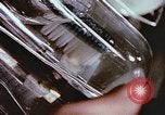 Standbild Advent der zahnärztlichen Fluorid-Behandlungen United States USA, 1957, aus Sekunde 26 historischem Filmmaterial Videoclip 65675023832