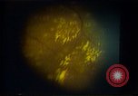 Image of Laser beam for eyes United States USA, 1985, second 5 stock footage video 65675024216
