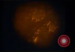 Image of Laser beam for eyes United States USA, 1985, second 6 stock footage video 65675024216