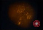 Image of Laser beam for eyes United States USA, 1985, second 7 stock footage video 65675024216