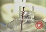 Image Cancer Therapy United States USA, 1985, de la seconde 19 séquences d'archives historiques vidéo 65675024219