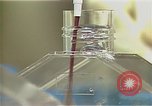 Image Cancer Therapy United States USA, 1985, de la seconde 20 séquences d'archives historiques vidéo 65675024219