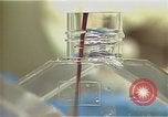 Image Cancer Therapy United States USA, 1985, de la seconde 21 séquences d'archives historiques vidéo 65675024219