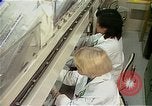 Image Cancer Therapy United States USA, 1985, de la seconde 24 séquences d'archives historiques vidéo 65675024219