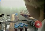 Image Cancer Therapy United States USA, 1985, de la seconde 25 séquences d'archives historiques vidéo 65675024219
