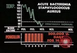 Image of penicillin United States USA, 1950, second 48 stock footage video 65675024755