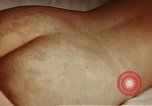 Image of penicillin United States USA, 1950, second 3 stock footage video 65675024756