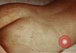 Image of penicillin United States USA, 1950, second 4 stock footage video 65675024756