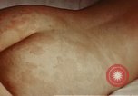 Image of penicillin United States USA, 1950, second 5 stock footage video 65675024756