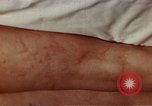 Image of penicillin United States USA, 1950, second 19 stock footage video 65675024756