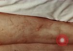 Image of penicillin United States USA, 1950, second 23 stock footage video 65675024756