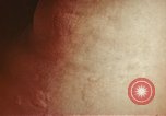 Image of penicillin United States USA, 1950, second 31 stock footage video 65675024756