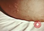Image of penicillin United States USA, 1950, second 33 stock footage video 65675024756