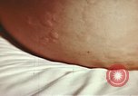 Image of penicillin United States USA, 1950, second 34 stock footage video 65675024756