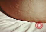 Image of penicillin United States USA, 1950, second 36 stock footage video 65675024756