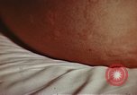 Image of penicillin United States USA, 1950, second 37 stock footage video 65675024756