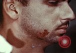 Standbild Penicillin United States USA, 1950, aus Sekunde 43 historischem Filmmaterial Videoclip 65675024761