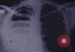 Standbild Penicillin United States USA, 1950, aus Sekunde 3 historischem Filmmaterial Videoclip 65675024762