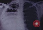 Standbild Penicillin United States USA, 1950, aus Sekunde 6 historischem Filmmaterial Videoclip 65675024762