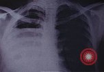 Standbild Penicillin United States USA, 1950, aus Sekunde 9 historischem Filmmaterial Videoclip 65675024762