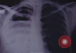 Standbild Penicillin United States USA, 1950, aus Sekunde 10 historischem Filmmaterial Videoclip 65675024762