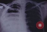 Standbild Penicillin United States USA, 1950, aus Sekunde 11 historischem Filmmaterial Videoclip 65675024762