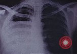 Standbild Penicillin United States USA, 1950, aus Sekunde 12 historischem Filmmaterial Videoclip 65675024762