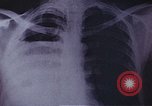 Standbild Penicillin United States USA, 1950, aus Sekunde 13 historischem Filmmaterial Videoclip 65675024762