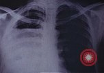 Standbild Penicillin United States USA, 1950, aus Sekunde 16 historischem Filmmaterial Videoclip 65675024762