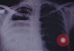 Standbild Penicillin United States USA, 1950, aus Sekunde 18 historischem Filmmaterial Videoclip 65675024762