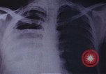Standbild Penicillin United States USA, 1950, aus Sekunde 19 historischem Filmmaterial Videoclip 65675024762