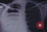 Standbild Penicillin United States USA, 1950, aus Sekunde 20 historischem Filmmaterial Videoclip 65675024762
