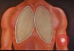 Standbild Penicillin United States USA, 1950, aus Sekunde 26 historischem Filmmaterial Videoclip 65675024762